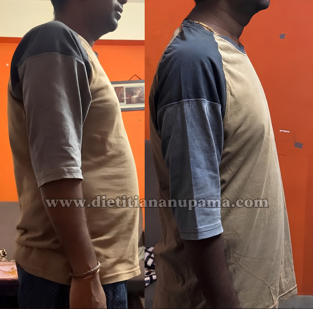 Weight Loss